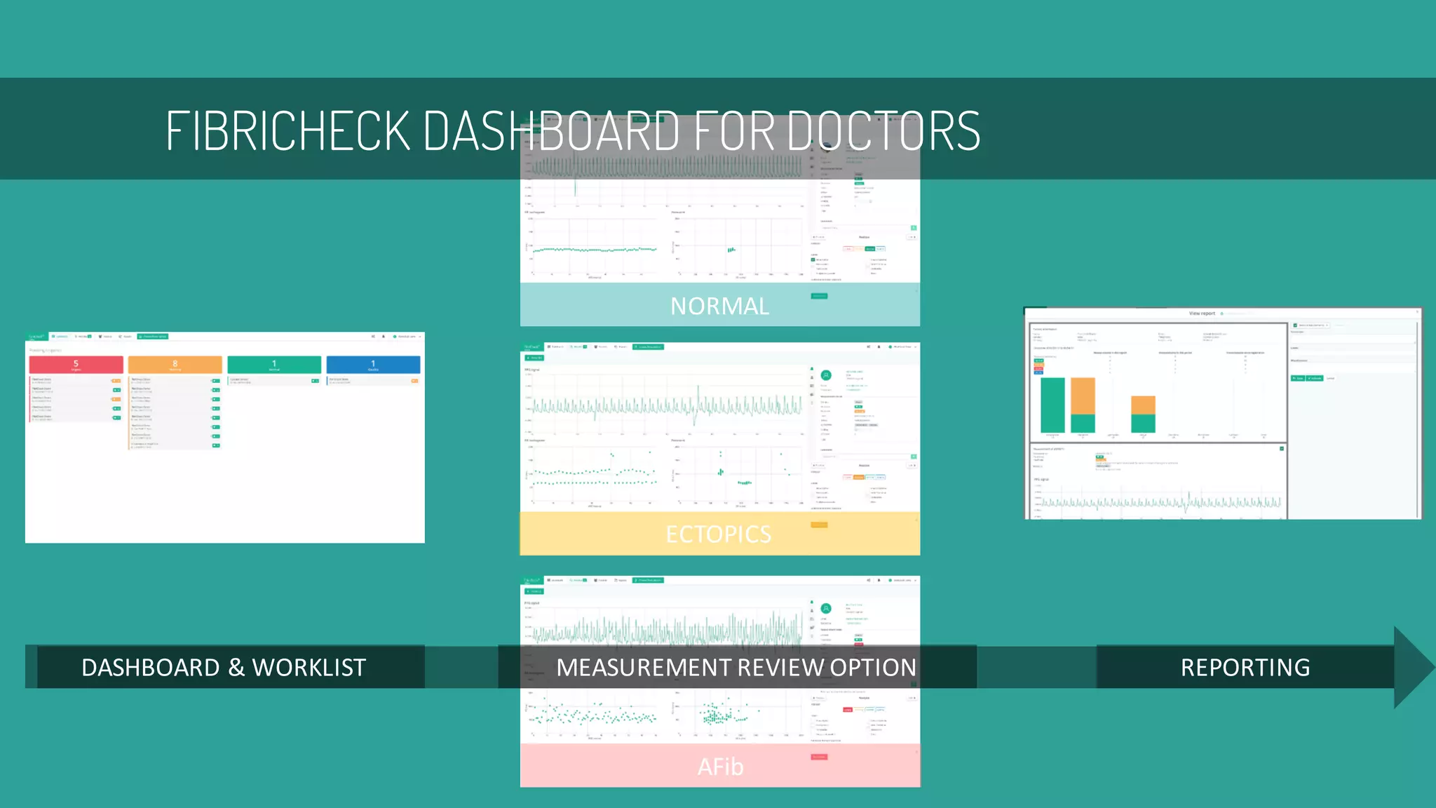 FIBRICHECK DASHBOARD FOR DOCTORS
DASHBOARD	&	WORKLIST REPORTINGMEASUREMENT	REVIEW	OPTION
NORMAL
ECTOPICS
AFib
 