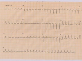 • Colocar os slides 1 e 2C
 