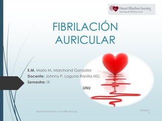 FIBRILACIÓN
AURICULAR
E.M. Mario M. Marchand Gonzales
Docente: Johnny P. Laguna Ranilla MD.
Semestre: IX
UNU
03/06/201
5
Heart Rhythm Society, www.HRSonline.org
 