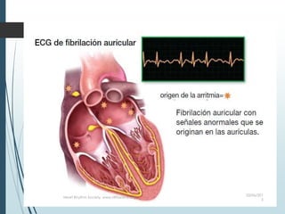 03/06/201
5
Heart Rhythm Society, www.HRSonline.org
 