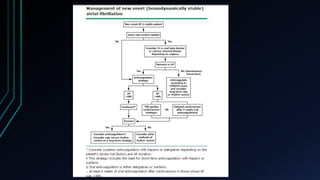 Fibrilación auricular