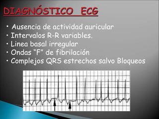 • Ausencia de actividad auricular
• Intervalos R-R variables.
• Linea basal irregular
• Ondas “F” de fibrilación
• Complejos QRS estrechos salvo Bloqueos
 
