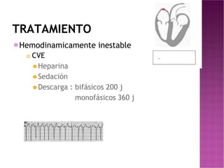 TRATAMIENTO
⦿Hemodinamicamente inestable
 CVE
⚫Heparina
⚫Sedación
⚫Descarga : bifásicos 200 j
monofásicos 360 j
 