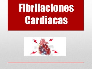 Fibrilaciones
Cardiacas
 