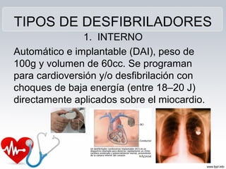 TIPOS DE DESFIBRILADORES
1. INTERNO
Automático e implantable (DAI), peso de
100g y volumen de 60cc. Se programan
para cardioversión y/o desfibrilación con
choques de baja energía (entre 18–20 J)
directamente aplicados sobre el miocardio.
 