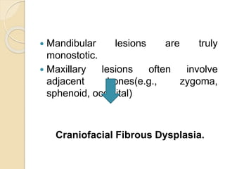  Mandibular lesions are truly 
monostotic. 
 Maxillary lesions often involve 
adjacent bones(e.g., zygoma, 
sphenoid, occipital) 
Craniofacial Fibrous Dysplasia. 
 