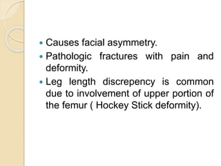  Causes facial asymmetry. 
 Pathologic fractures with pain and 
deformity. 
 Leg length discrepency is common 
due to involvement of upper portion of 
the femur ( Hockey Stick deformity). 
 