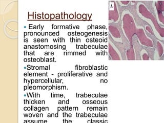 Histopathology 
 Early formative phase, 
pronounced osteogenesis 
is seen with thin osteoid 
anastomosing trabeculae 
that are rimmed with 
osteoblast. 
Stromal fibroblastic 
element - proliferative and 
hypercellular, no 
pleomorphism. 
With time, trabeculae 
thicken and osseous 
collagen pattern remain 
woven and the trabeculae 
assume the classic 
 