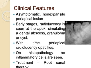 Clinical Features 
 Asymptomatic, nonexpansile 
periapical lesion 
 Early stages, radiolucency is 
seen at the apex, simulating 
a dental abscess, granuloma 
or cyst. 
 With time periapical 
radiolucency opacifies. 
 On histopathology no 
inflammatory cells are seen. 
 Treatment – Root canal 
therapy 
 