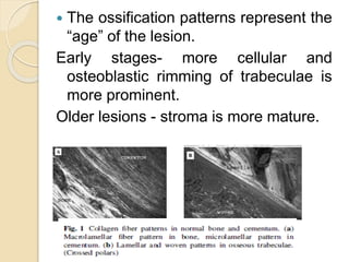 The ossification patterns represent the 
“age” of the lesion. 
Early stages- more cellular and 
osteoblastic rimming of trabeculae is 
more prominent. 
Older lesions - stroma is more mature. 
 