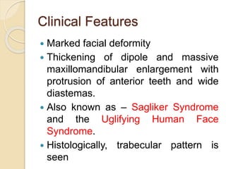 Clinical Features 
 Marked facial deformity 
 Thickening of dipole and massive 
maxillomandibular enlargement with 
protrusion of anterior teeth and wide 
diastemas. 
 Also known as – Sagliker Syndrome 
and the Uglifying Human Face 
Syndrome. 
 Histologically, trabecular pattern is 
seen 
 