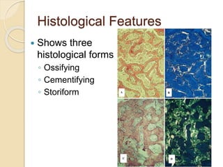 Histological Features 
 Shows three 
histological forms 
◦ Ossifying 
◦ Cementifying 
◦ Storiform 
 