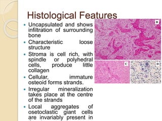 Histological Features 
 Uncapsulated and shows 
infiltration of surrounding 
bone 
 Characteristic loose 
structure 
 Stroma is cell rich, with 
spindle or polyhedral 
cells, produce little 
collagen 
 Cellular, immature 
osteoid forms strands. 
 Irregular mineralization 
takes place at the centre 
of the strands 
 Local aggregates of 
osetoclastic giant cells 
are invariably present in 
the stroma. 
 