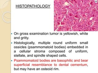HISTOPATHOLOGY 
 On gross examination tumor is yellowish, white 
and gritty. 
 Histologically, multiple round uniform small 
ossicles (psammomatoid bodies) embedded in 
a cellular stroma composed of uniform, 
stellate, and spindle shaped cells. 
 Psammomatoid bodies are basophilic and bear 
superficial resemblance to dental cementum, 
but may have an osteoid rim. 
 