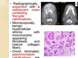  Radiographically, 
expansion with a 
radiolucent mass 
containing 
floccular 
calcifications. 
 Microscopically, 
benign 
hypercellular 
stroma with 
monomorphic 
appearing 
fibroblasts and 
mature collagen 
fibers. 
 Ovoid, laminated, 
psammomatoid 
calcifications are 
 