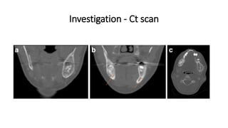 Investigation - Ct scan
 
