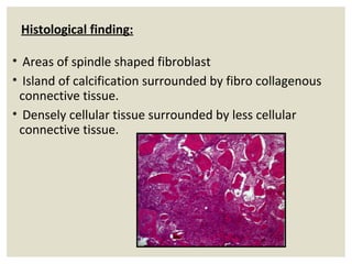 Fibro Osseous Lesions | PPT