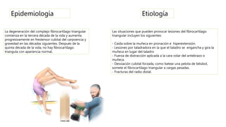 La degeneración del complejo fibrocartílago triangular
comienza en la tercera década de la vida y aumenta
progresivamente en frestensor cubital del carpoencia y
gravedad en las décadas siguientes. Después de la
quinta década de la vida, no hay fibrocartílago
triangula con apariencia normal.
Epidemiología Etiología
Las situaciones que pueden provocar lesiones del fibrocartílago
triangular incluyen los siguientes:
- Caída sobre la muñeca en pronación e hiperextensión.
- Lesiones por taladradora en la que el taladro se engancha y gira la
muñeca en lugar del taladro
- Fuerza de distracción aplicada a la cara volar del antebrazo o
muñeca.
- Desviación cubital forzada, como batear una pelota de béisbol,
somete el fibrocartílago triangular a cargas pesadas.
- Fracturas del radio distal.
 