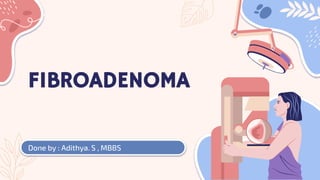 FIBROADENOMA
Done by : Adithya. S , MBBS
 
