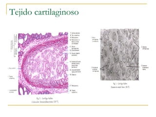 Tejido cartilaginoso
 