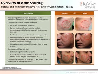 Overview of Acne Scarring
Natural and Minimally Invasive First-Line or Combination Therapy

                                                 Description               Before      After
        • Acne scarring is the permanent discoloration and/or
          indentation of the skin as a result of moderate to severe acne
        • Opportunity to capture a large market share
              o No current treatments for acne scars
              o Current treatments for acne scarring are both
                uncomfortable and ineffective, especially for depressed
                acne scars
              o First line therapy and combination therapy opportunities
              o Fibrocell estimates ~3 million patients (50 million
                Americans with acne x 20% with moderate to severe acne x
                30% who will develop scarring)
              o Fibrocell estimates capture of 5% market share for acne
                scarring
        • Completed one Phase II/III study
              o Statistically significant efficacy results
              o Currently in discussions with FDA on the evaluation of
                Phase II results and path towards Phase III
        • Opportunity to generate an estimated $4,000 to $5,000 per
          patient for acne scarring treatment (1)


 (1) Includes initial treatment only.
 Note: Photos from Fibrocell clinical studies.


                                                                                                14
 