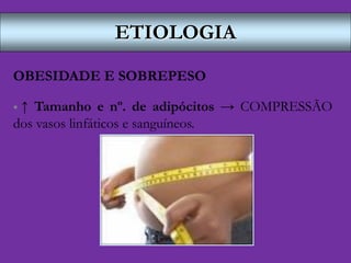 ETIOLOGIA
OBESIDADE E SOBREPESO
 ↑ Tamanho e nº. de adipócitos → COMPRESSÃO
dos vasos linfáticos e sanguíneos.
 