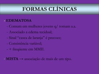 FORMAS CLÍNICAS
 EDEMATOSA
- Comum em mulheres jovens q/ tomam a.a.
- Associado a edema tecidual;
- Sinal “casca de laranja” é precoce;
- Consistência variável;
- + freqüente em MMII.
 MISTA → associação de mais de um tipo.
 
