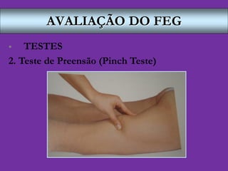 AVALIAÇÃO DO FEG
 TESTES
2. Teste de Preensão (Pinch Teste)
 