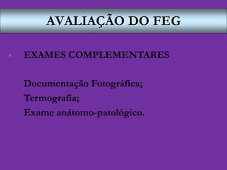 AVALIAÇÃO DO FEG
 EXAMES COMPLEMENTARES
- Documentação Fotográfica;
- Termografia;
- Exame anátomo-patológico.
 