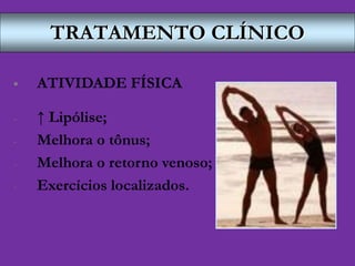 TRATAMENTO CLÍNICO
 ATIVIDADE FÍSICA
- ↑ Lipólise;
- Melhora o tônus;
- Melhora o retorno venoso;
- Exercícios localizados.
 