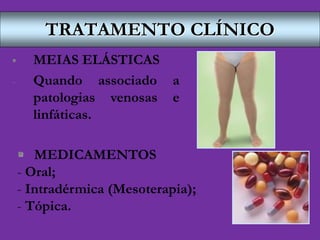 TRATAMENTO CLÍNICO
 MEIAS ELÁSTICAS
- Quando associado a
patologias venosas e
linfáticas.
 MEDICAMENTOS
- Oral;
- Intradérmica (Mesoterapia);
- Tópica.
 