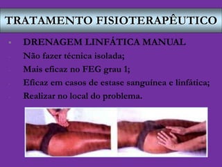 TRATAMENTO FISIOTERAPÊUTICO
 DRENAGEM LINFÁTICA MANUAL
- Não fazer técnica isolada;
- Mais eficaz no FEG grau 1;
- Eficaz em casos de estase sanguínea e linfática;
- Realizar no local do problema.
 