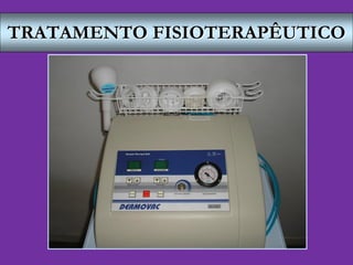 TRATAMENTO FISIOTERAPÊUTICO
 