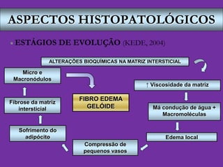 ASPECTOS HISTOPATOLÓGICOS
 ESTÁGIOS DE EVOLUÇÃO (KEDE, 2004)
ALTERAÇÕES BIOQUÍMICAS NA MATRIZ INTERSTICIAL
↑ Viscosidade da matriz
Má condução de água +
Macromoléculas
Edema local
Compressão de
pequenos vasos
Sofrimento do
adipócito
Fibrose da matriz
intersticial
FIBRO EDEMA
GELÓIDE
Micro e
Macronódulos
 