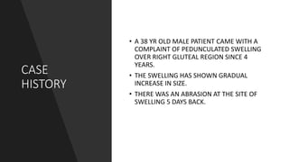 CASE
HISTORY
• A 38 YR OLD MALE PATIENT CAME WITH A
COMPLAINT OF PEDUNCULATED SWELLING
OVER RIGHT GLUTEAL REGION SINCE 4
YEARS.
• THE SWELLING HAS SHOWN GRADUAL
INCREASE IN SIZE.
• THERE WAS AN ABRASION AT THE SITE OF
SWELLING 5 DAYS BACK.
 