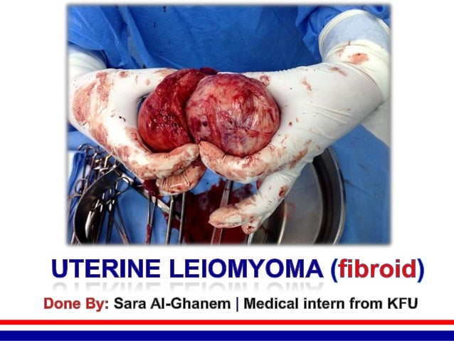Definition Prevalence Risk Factors Cl Ification Clinical Manifestations Diagnosis Management Definition Of Definition Prevalence Risk Factors Cl Ification Clinical Manifestations Diagnosis Management Definition Of