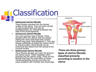 Fibroid2 | PPT