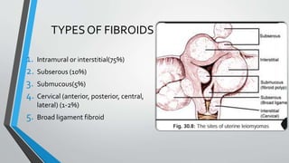 Fibroid Structure FIBROID%20UTERUS%20FINAL%20PPT copy.pptx