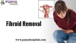 Fibroid Removal
www.punyahospitals.com
 