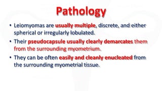 Pathology
• Leiomyomas are usually multiple, discrete, and either
spherical or irregularly lobulated.
• Their pseudocapsule usually clearly demarcates them
from the surrounding myometrium.
• They can be often easily and cleanly enucleated from
the surrounding myometrial tissue.
 