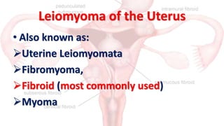 Leiomyoma/Fibroids
• A leiomyoma is a benign tumor composed mainly of
smooth muscle cells but containing varying amounts
o...