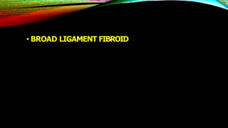 • BROAD LIGAMENT FIBROID
 
