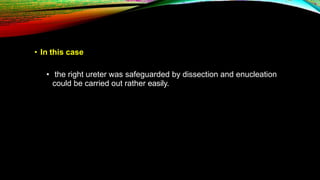 • In this case
• the right ureter was safeguarded by dissection and enucleation
could be carried out rather easily.
 