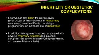 INFERTILITY OR OBSTETRIC
COMPLICATIONS
• Leiomyomas that distort the uterine cavity
(submucosal or intramural with an intracavitary
component) result in difficulty conceiving a
pregnancy and an increased risk of miscarriage
• In addition, leiomyomas have been associated with
adverse pregnancy outcomes (eg, placental
abruption, fetal growth restriction, malpresentation,
and preterm labor and birth)
 
