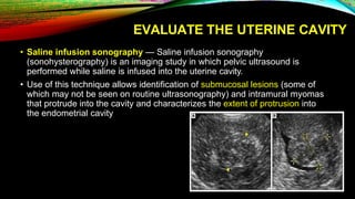 EVALUATE THE UTERINE CAVITY
• Saline infusion sonography — Saline infusion sonography
(sonohysterography) is an imaging study in which pelvic ultrasound is
performed while saline is infused into the uterine cavity.
• Use of this technique allows identification of submucosal lesions (some of
which may not be seen on routine ultrasonography) and intramural myomas
that protrude into the cavity and characterizes the extent of protrusion into
the endometrial cavity
 