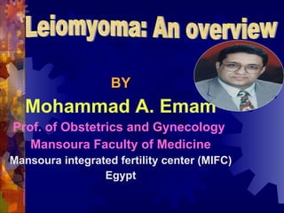 [object Object],[object Object],[object Object],[object Object],[object Object],[object Object],Leiomyoma: An overview  