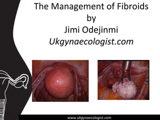 www.ukgynaecologist.comwww.ukgynaecologist.com
The Management of Fibroids
by
Jimi Odejinmi
Ukgynaecologist.com
 