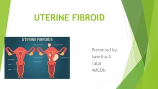 UTERINE FIBROID
Presented by:
Suvetha.G
Tutor
VMCON
 
