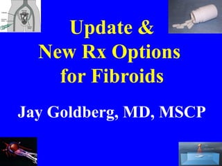 Update &
New Rx Options
for Fibroids
Jay Goldberg, MD, MSCP
 