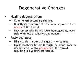 Degenerative Changes
• Hyaline degeneration:
– Commonest secondary change.
– Usually starts around the menopause, and in the
center of the fibroid.
– Macroscopically, fibroid looks homogenous, waxy,
soft, with loss of whorly appearance.
• Fatty changes:
– Likely to start around the age of menopause.
– Lipids reach the fibroid through the blood, so fatty
change starts at the periphery of the fibroid,
resulting in a yellow soft fibroid.
 